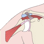 Shoulder arthroscopy