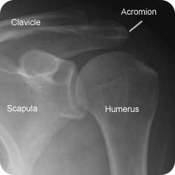xr-shoulder-ap-normal-250-label-1
